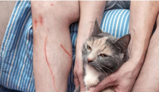 Bị mèo cào, người đàn ông 71 tuổi tử vong trong đau đớn