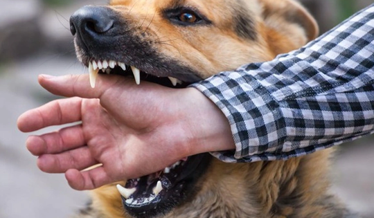 Chó nghi bị dại cắn liên tiếp 3 người trong một xã, 1 nạn nhân tử vong
