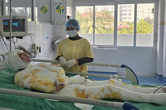 Bạn đọc Dân trí tiếp sức người bố đơn thân bị bỏng nặng hơn 400 triệu đồng
