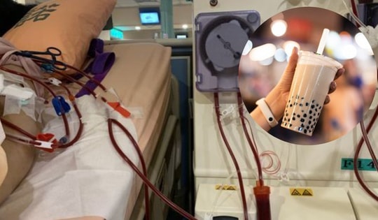 Uống thứ nước nhiều người mê, cô gái bị sưng mặt suốt 6 tháng và cái kết