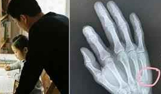 Con viết 18 chữ sau 30 phút học, người cha tức giận đập bàn… và cái kết khó tin