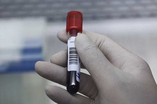 8 lầm tưởng về cholesterol qua góc nhìn của bác sĩ tim mạch