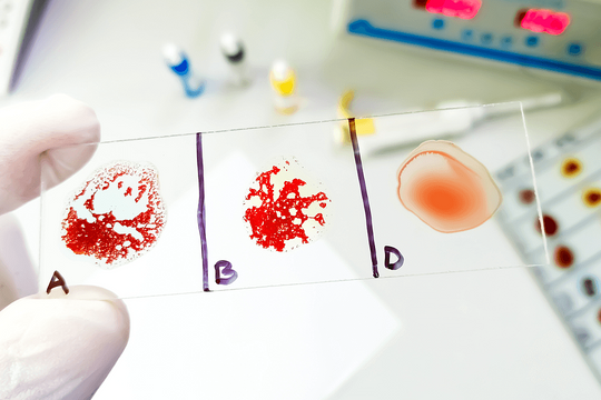 Người phụ nữ mang nhóm 'máu khủng long' cực hiếm tại Trung Quốc