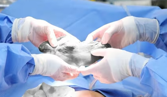 Đau bụng kéo dài, người phụ nữ đi khám phát hiện bí mật đáng sợ