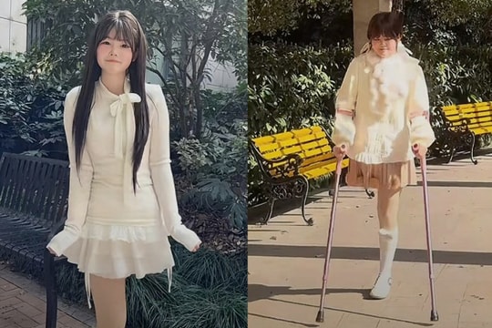 Cô gái ung thư xương bị gia đình bỏ rơi, tự ký giấy phẫu thuật