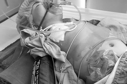 Cơ hội sống duy nhất của cậu bé bị đột biến gene