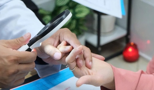 Da đỏ sậm, bong tróc khi trời lạnh, người phụ nữ Hà Nội phải cầu cứu bác sĩ