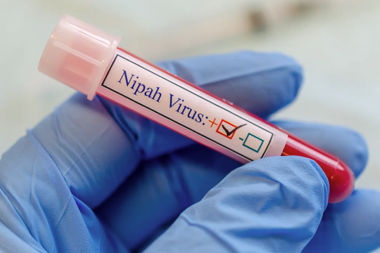 Virus Nipah có nguy hiểm như Covid-19?