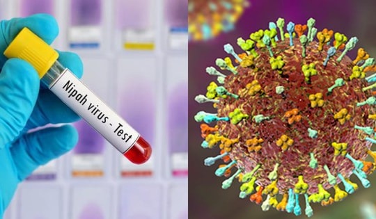 Bộ Y tế hoả tốc yêu cầu cơ sở khám chữa bệnh chủ động phòng chống bệnh do virus Nipah