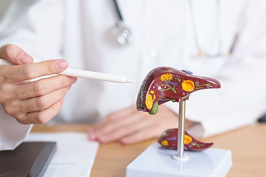 Bác sĩ giải mã hiện tượng khối u gan 6 cm tự 'bốc hơi'