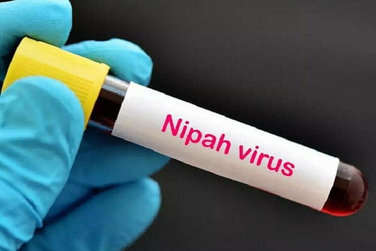 Dấu hiệu nhiễm virus Nipah dễ nhầm với cảm cúm
