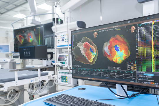 Bệnh viện Chợ Rẫy triển khai hệ thống thông tim hiện đại nhất phía Nam