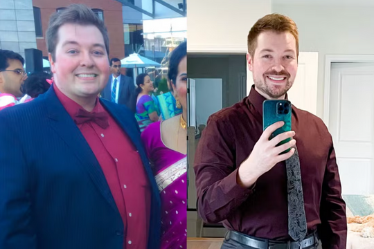 Bác sĩ Mỹ giảm 56 kg sau nhiều năm 'ăn uống để giải tỏa'