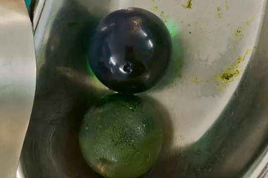 Hạt nở 'lớn nhanh' gấp 300 lần gây tắc ruột bé gái