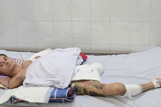 Từ trụ cột thành tàn phế: Lời cầu cứu xé lòng của người bố hai con