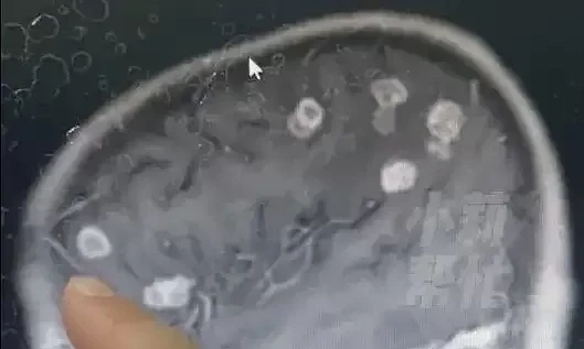 Bé gái bị nấm 'ăn não' khi dọn nhà đón Tết