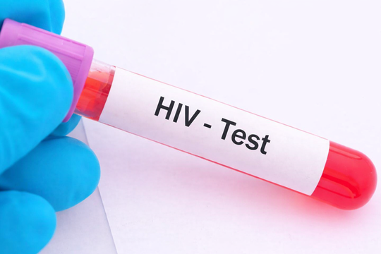 5 bệnh 'sát thủ thầm lặng' ít dấu hiệu cảnh báo