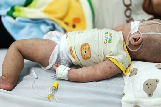 Những bệnh truyền nhiễm dễ mắc dịp Tết