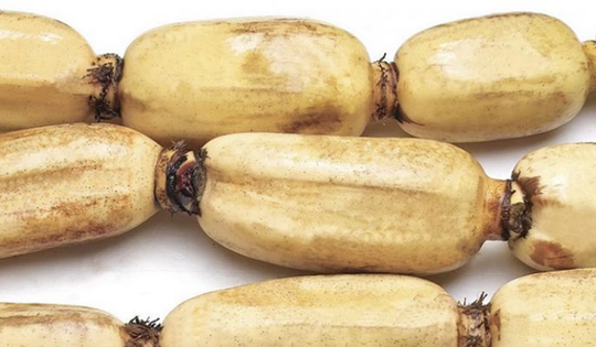 2 loại củ dễ là “ổ ký sinh trùng" mắt thường không thấy được, loại đầu bảng nhiều người mê