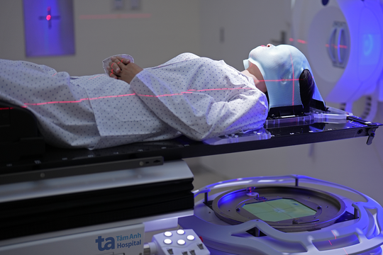 Xạ trị sau phẫu thuật u não như thế nào?