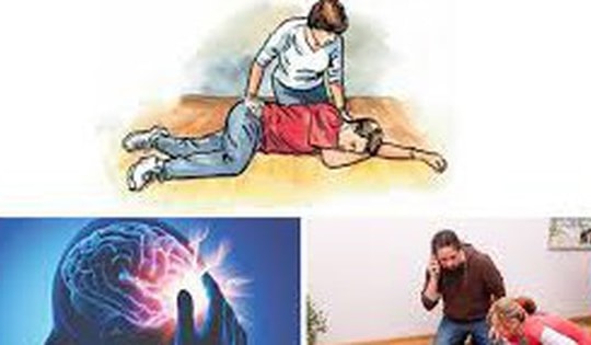 Đột quỵ não gia tăng và những dấu hiệu cảnh báo