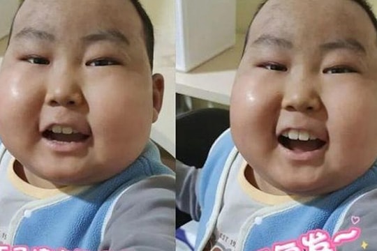 Cậu bé ung thư coi thuốc đắng là 'món tráng miệng'