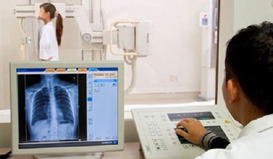 Bộ Y tế: Không lấy thời gian chụp X-quang 6 phút làm căn cứ từ chối thanh toán BHYT