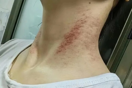 Nhật ký tuyệt vọng của nữ y tá trong 5 năm bị bạo hành