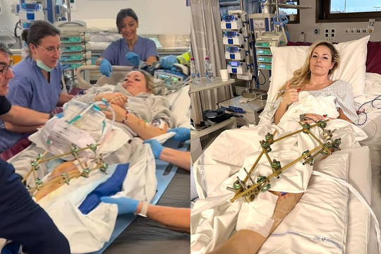 Gặp nạn ở Olympic, huyền thoại trượt tuyết Lindsey Vonn nguy cơ bị cắt cụt chân