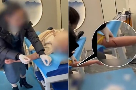 Nhóm bác sĩ rởm dùng liệu pháp trích máu để 'đuổi tà khí'