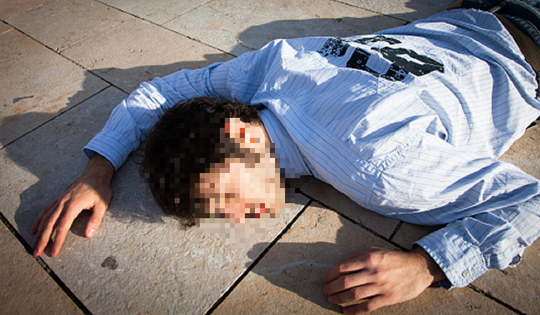 Người đàn ông 35 tuổi đột tử, bác sĩ cảnh báo 2 vùng nguy hiểm dễ bị bỏ qua