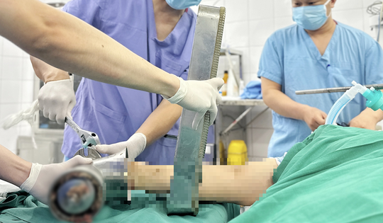 Một phút bất cẩn bên máy xay thịt, người phụ nữ trẻ phải trả giá đắt