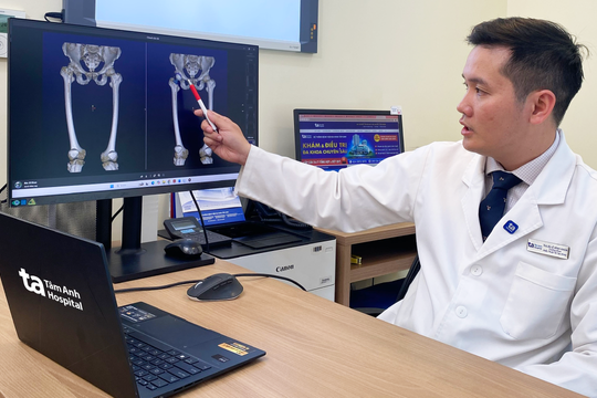 Cột sống, khớp háng dính cứng hơn 10 năm