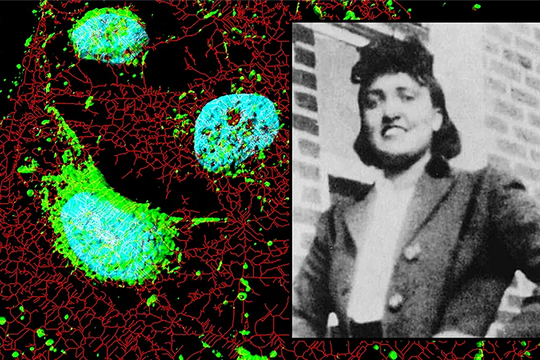 Gia đình người có 'tế bào bất tử' đạt thỏa thuận với công ty dược