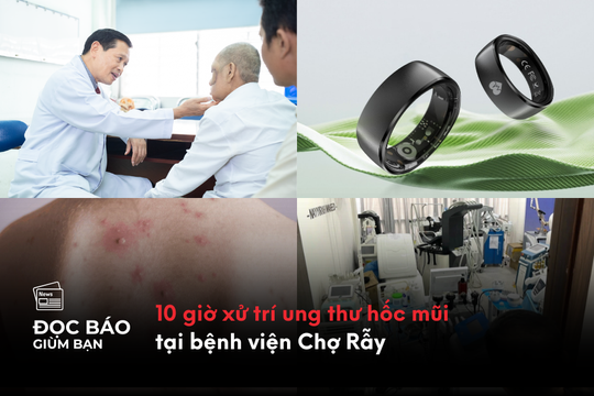 10 giờ xử trí ung thư hốc mũi tại bệnh viện Chợ Rẫy
