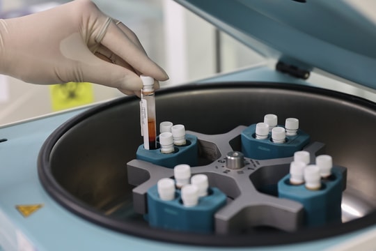 Hỏng 'chuyện ấy' vì béo bụng, mỡ nội tạng