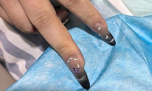 Bệnh viện cầu cứu thợ làm móng để kịp cứu cô gái nguy kịch