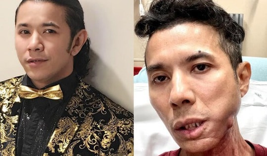 Kasim Hoàng Vũ qua đời sau thời gian bạo bệnh