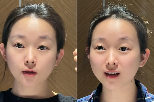 Nữ thiết kế 33 tuổi gây sốt vì khuôn mặt như trẻ em