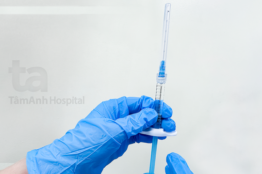 Đang niềng răng có tiêm filler được không?