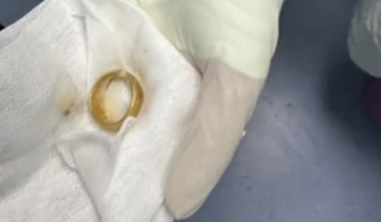 Khám cho cụ ông, bác sĩ phát hiện ra "bí mật" bất ngờ