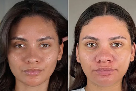 Cú sốc 'mặt phá nét' của nữ Influencer trong lần đầu mang thai