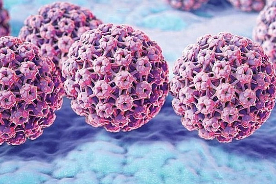 Thai phụ 20 tuổi mắc sùi mào gà