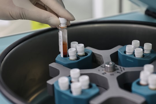 Vòng eo to tàn phá nội tạng thế nào