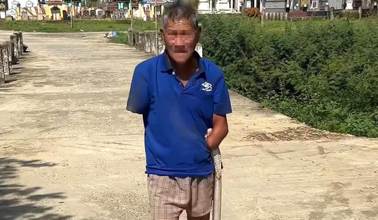 Bị rắn hổ mang cắn, người đàn ông vẫn kẹp chặt con rắn mang về nhà