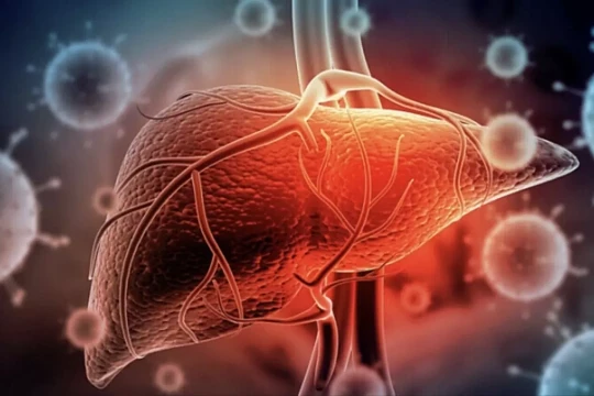 Tưởng đau bụng thông thường, hóa ung thư gan giai đoạn cuối