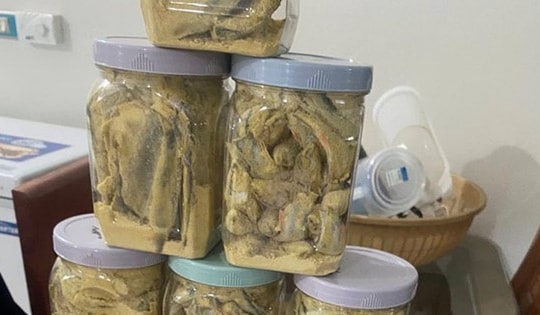 Thêm 2 trường hợp nghi ngộ độc cá ủ chua ở Đà Nẵng, Bộ Y tế chỉ đạo nóng