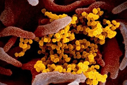 Biến thể Covid 'Ve sầu' siêu đột biến lây lan tại Mỹ