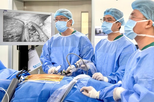 Ung thư thực quản di căn gây đau ngực