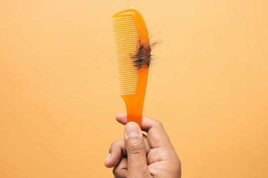 Mẹ rụng tóc từng mảng vì áp lực dạy con học